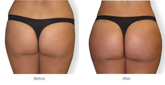 agelesslasercentres