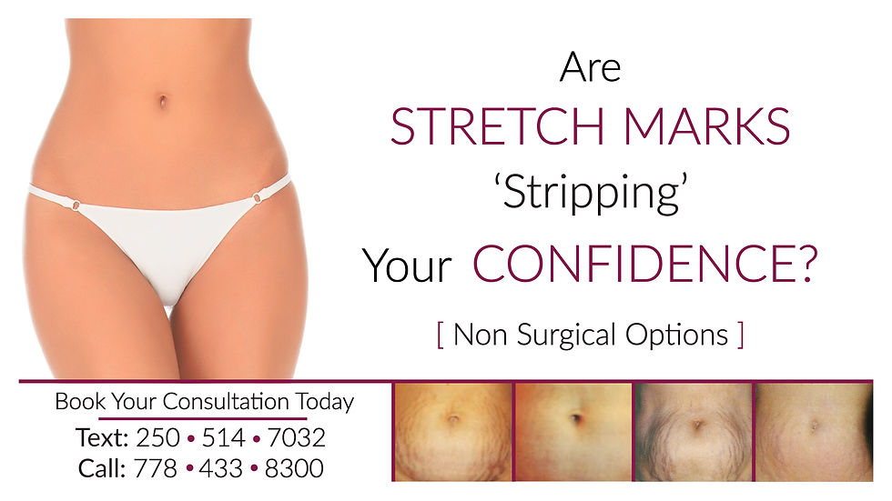 Stretch Mark Therapy