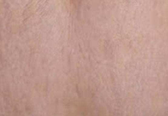 agelesslasercentres