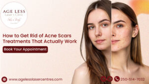 Learn how to reduce acne scars with proven treatments like lasers, microneedling, peels, and skincare. Find the best option for your skin.